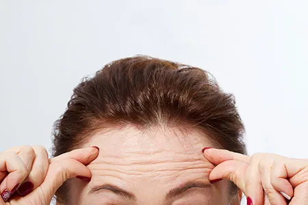 Forehead with wrinkle lines