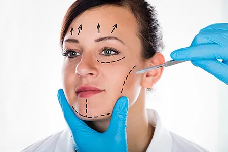 Woman with lines drawn on face for facelift